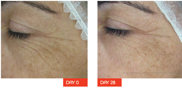 Dermaceutic Active Retinol 1% - Dermazone Store - UAE